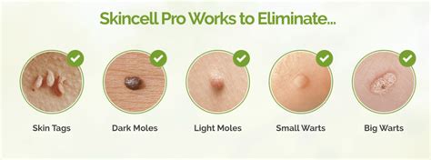 skincell review best at home skin tag and moles removal