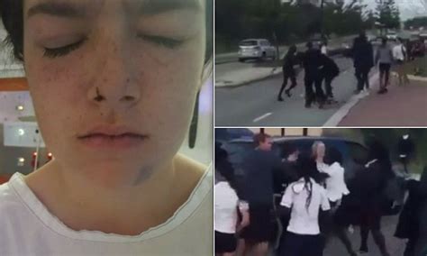 Perth School Brawl Ended With 15 Year Old Girl Having Her