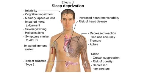 10 negative side effects of sleep deprivation