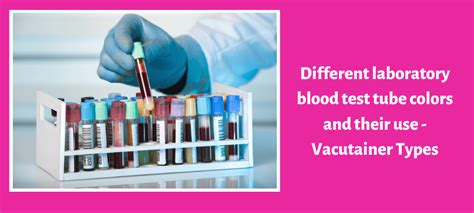 laboratory blood test tube colors