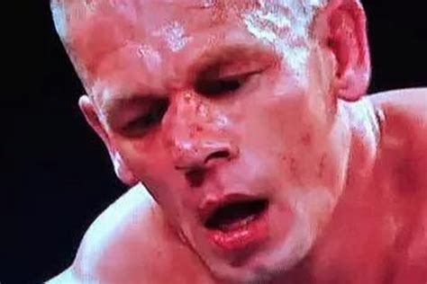 john cena broke his nose on monday night raw total pro