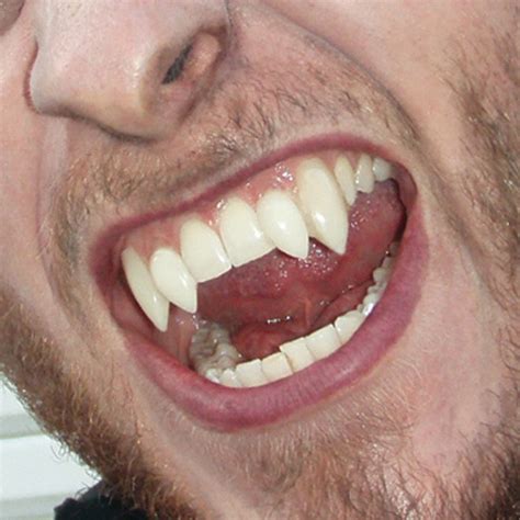 werewolf fangs fake halloween teeth shindigscomau