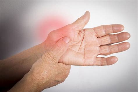 rheumatoid arthritis sufferers   die earlier