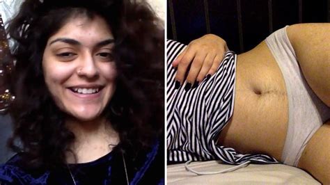 Female hairy stomachs