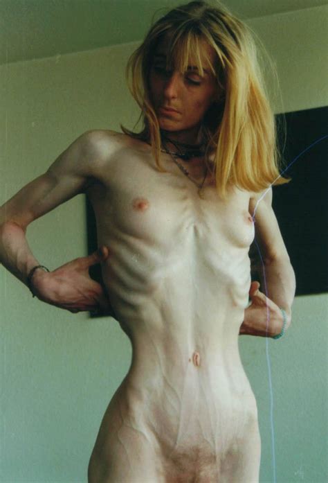 skinnyfans anorexic sonja image 4 fap