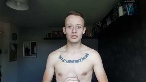 Ftm Update Stage 1 Phalloplasty 5 Days Post Op Youtube
