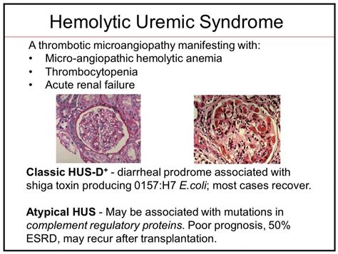 Uremic Syndrome Symptoms