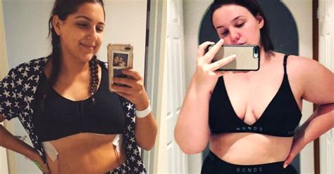 breast reduction before and after 7 women share their stories