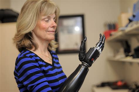 preparing  thought controlled prosthetic arm baltimore sun