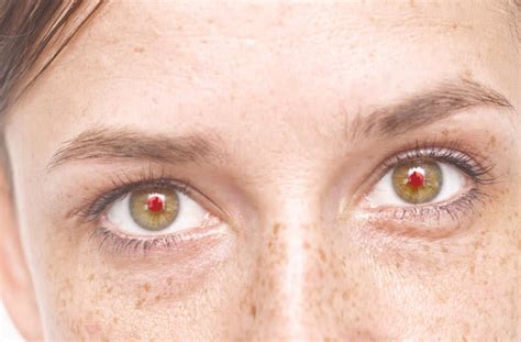 People With Red Eyes