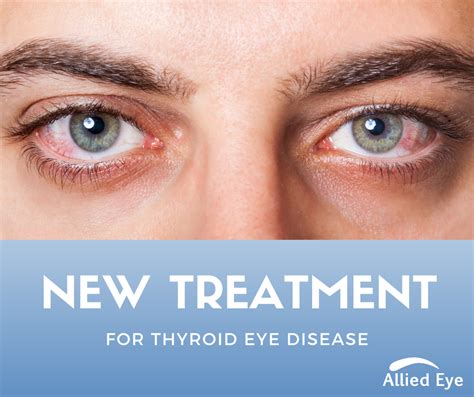 treatment  thyroid eye disease