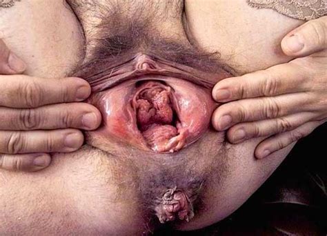 gross looking vagina