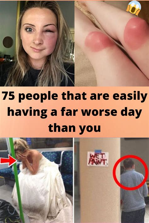 75 People That Are Easily Having A Far Worse Day Than You Fun Facts