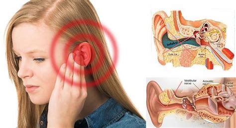 mengobati telinga bernanah secara alami farmakepoo