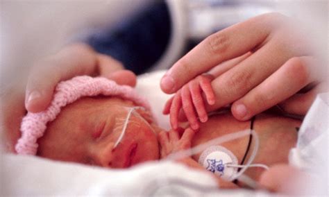 premature babies born   weeks  surviving   number