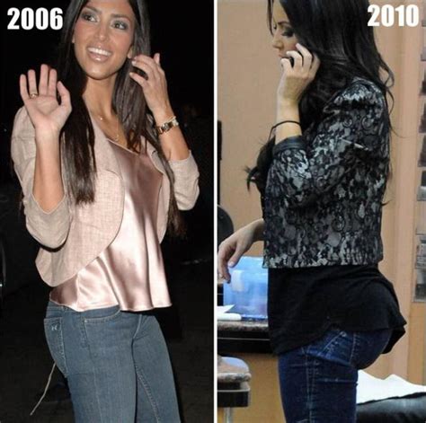 Kim Kardashian Butt Implants