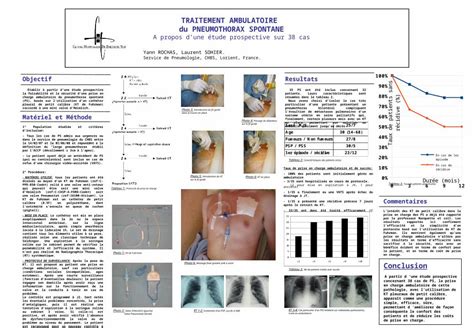 Ppt Traitement Ambulatoire Du Pneumothorax Spontane A Propos Dune