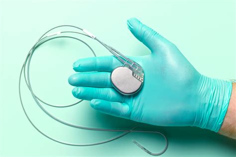 pacemaker procedure ucsf benioff childrens hospitals