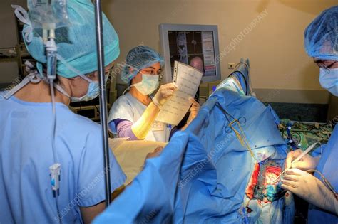 brain surgery stock image  science photo library