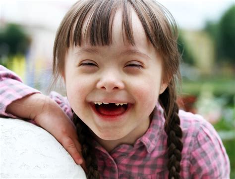 why dawkins is wrong about people with down s syndrome life