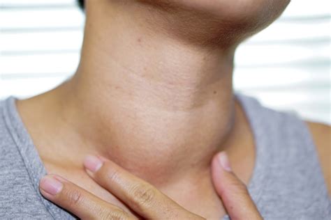 thyroid goiter ezra detect cancer early  mri  ai