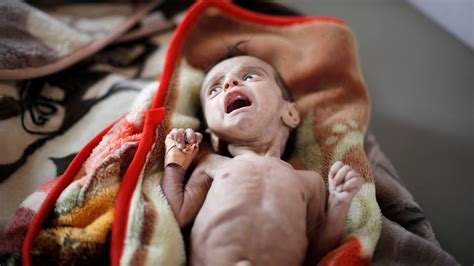yemen is undeniably the world s worst humanitarian crisis