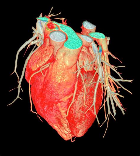 human heart photograph    fungscience photo library fine art america