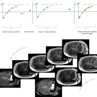 iron corrected  ct liver mapping   axial iron corrected  map  scientific
