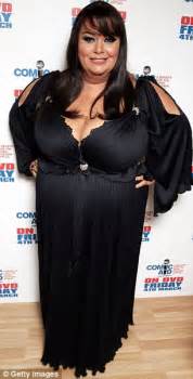 Dawn French On Her 8st Weight Loss I M Still Quite Fond Of My Fat