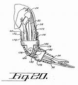 Patents Prosthetic sketch template