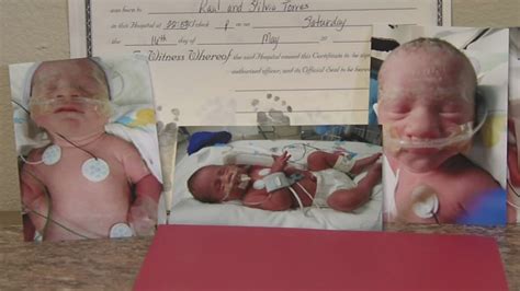 identical triplets born  texas hospital includes set  conjoined twins abc los angeles
