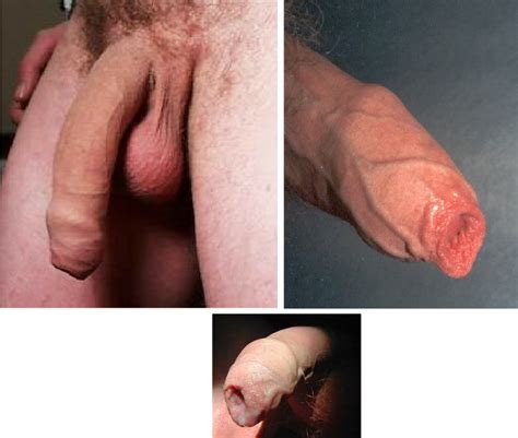 uncircumsized penis picture sex nurse local
