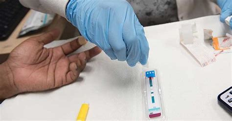 ummc clinic enhances access to free hiv testing
