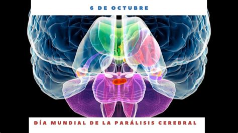 DÍa Mundial De La ParÁlisis Cerebral 6 De Octubre Día Internacional Hoy