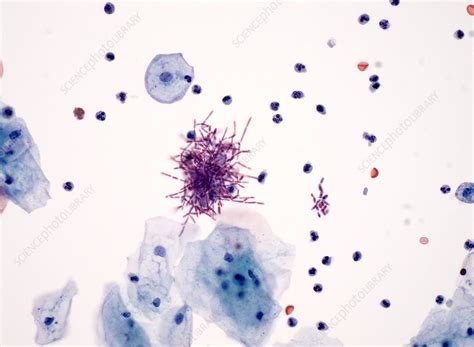 yeast  urine light micrograph stock image  science photo library