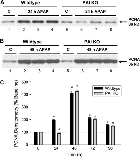 Western Blot Analysis Of Pcna Expression In Livers Of Controls Or