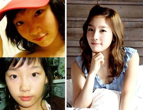 Snsd Plastic Surgery Before And After Taeyeon And Tiffany
