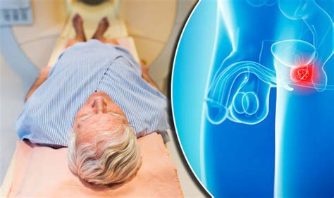 Prostate Cancer Sex And Ejaculation Could Protect Men From Disease