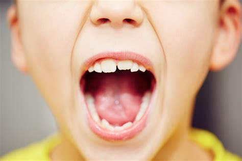 dentistry  children   childs teeth developing