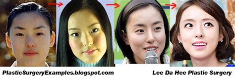 Plastic Surgery Examples July 2013