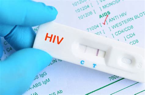 when is the most accurate hiv test