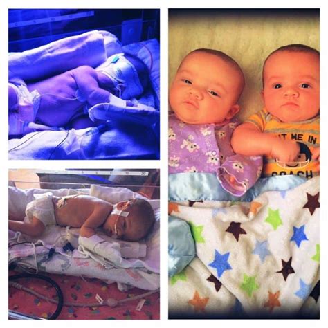 A Beautiful Gallery Of Preemie Twins Before And After