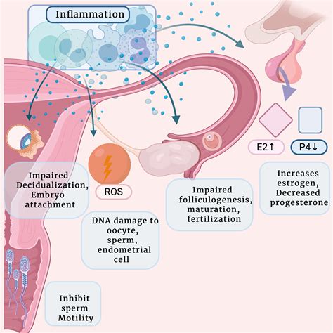 cureus inflammation  infertility panoramic view  endometriosis