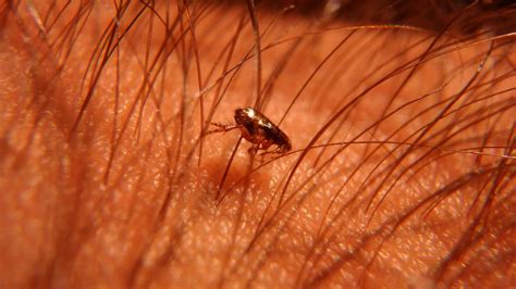 sand flea disease  neglected