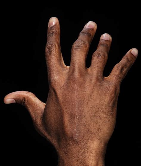 Chris Paul’s Fast Hands And Gruesome Fingers The New York Times
