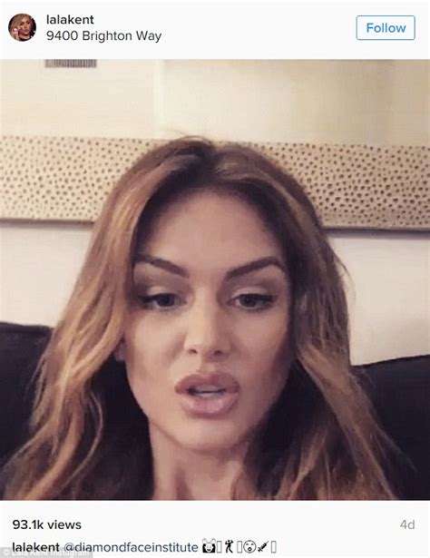 lala kent reveals on instagram how she used botox to transform her face