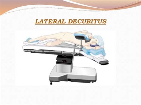 left lateral decubitus position  left lateral decubitus  ray  day