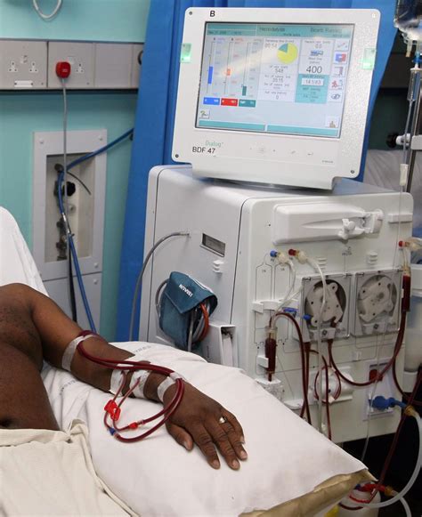dialysis equipment shortage  procurement official urges care  nhs