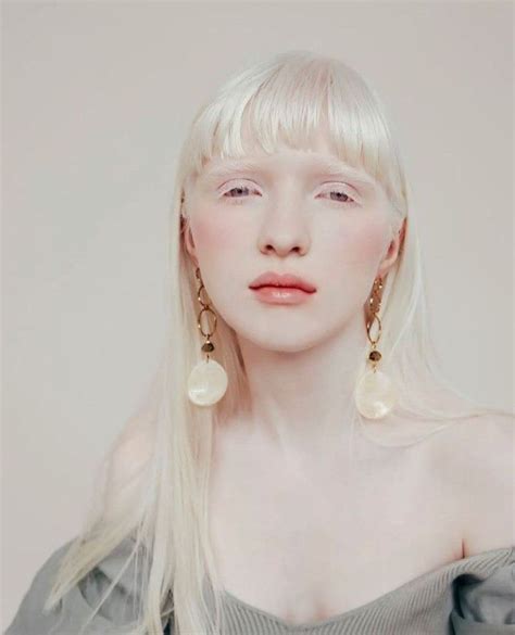 10 potret nastya zhidkova model albino populer asal ukraina