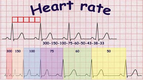 Ecg Basics Methods Of Heart Rate Calculation Nursing School Notes